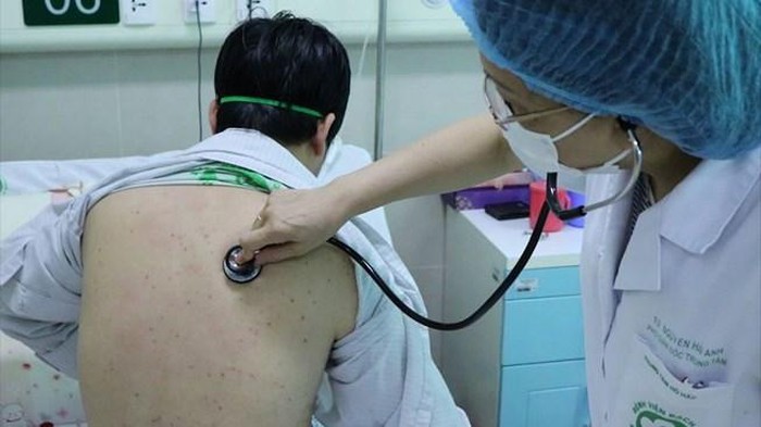 HIẾM: Lần đầu tiên trong 35 năm, xuất hiện người trưởng thành mắc bệnh ho gà