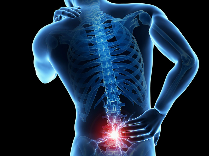 Nhuyễn xương – Triệu chứng & Nguyên nhân nhận biết bệnh