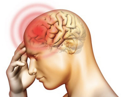 Viêm màng não – Tìm hiểu cách phát hiện bệnh