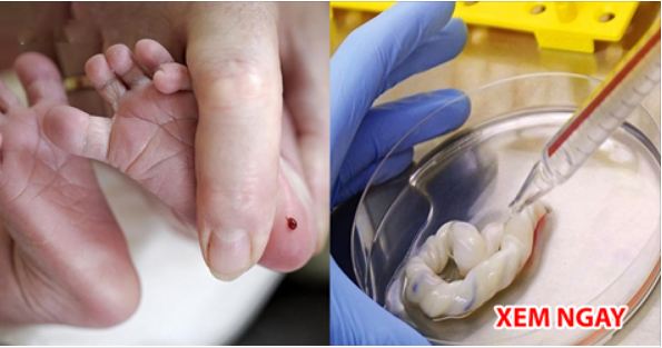 2 thứ của trẻ sau sinh quý hơn vàng, cha mẹ nên cất giữ phòng cứu mạng con sau này