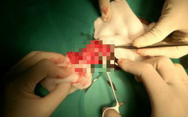 Bác sĩ Việt tại Lào hội chẩn xuyên quốc gia, cứu người đàn ông hoại tử bộ phận sinh dục