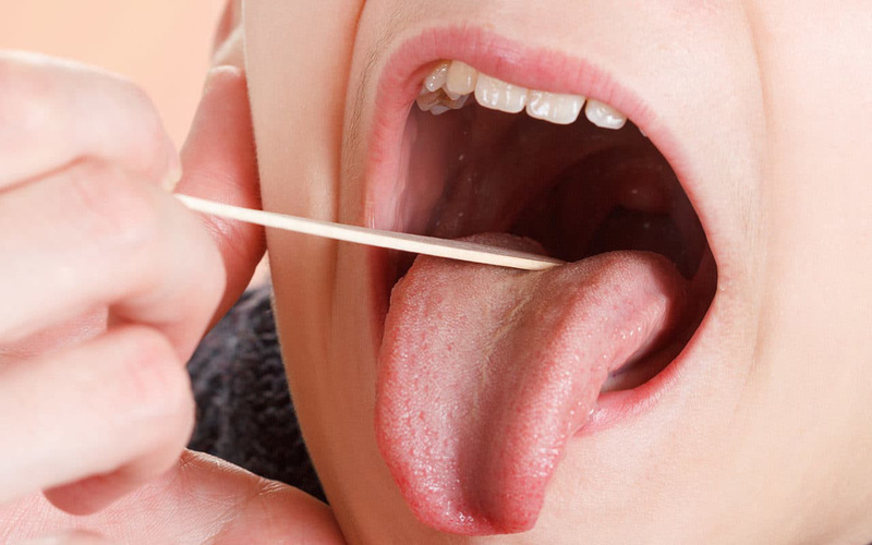 Bật mí các cách trị viêm amidan tại nhà hiệu quả