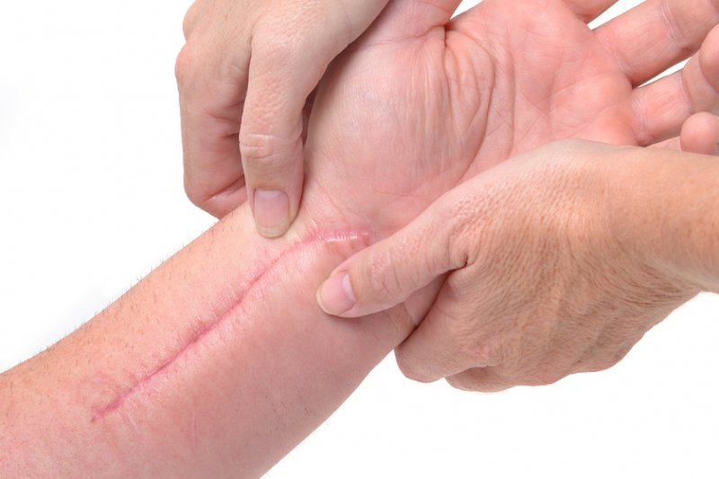Chia sẻ cho mọi người biết ăn gì nhanh liền sẹo