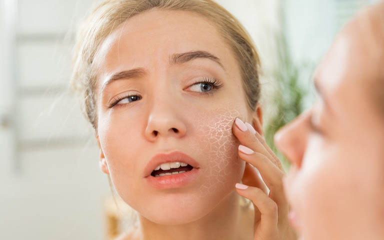 Cách trị da khô nứt nẻ vào mùa đông với các nguyên liệu từ tự nhiên
