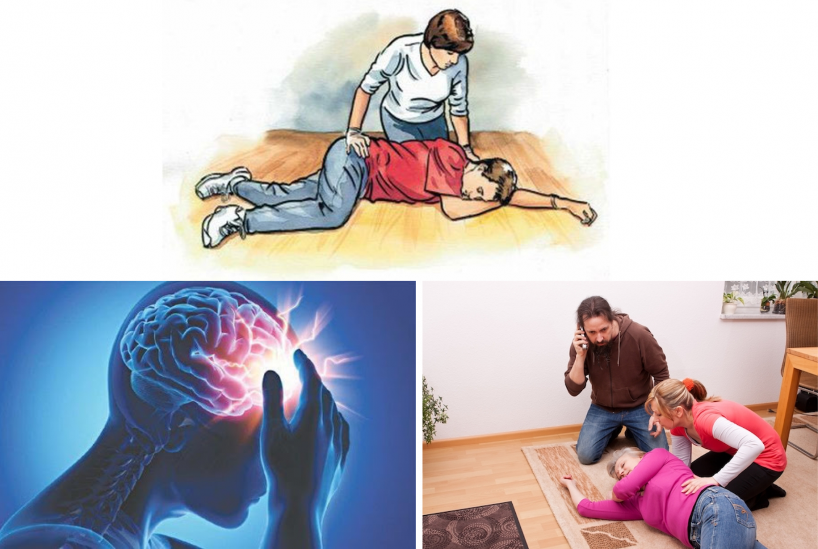 Hướng dẫn cách xử lý khi gặp đột quỵ