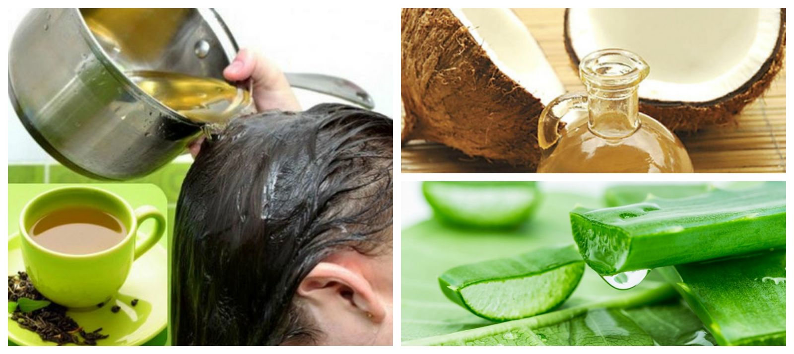 5 cách trị rụng tóc, hói đầu đơn giản ngay tại nhà