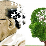 Bệnh Alzheimer - Nguyên nhân & Phương pháp điều trị bệnh