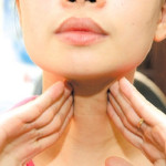 Cường giáp trạng và nguyên nhân gây bệnh
