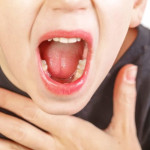 Đâu là những triệu chứng ung thư vòm họng?