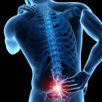 Nhuyễn xương - Triệu chứng & Nguyên nhân nhận biết bệnh