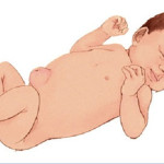 Thoát vị rốn là gì? Đâu là nguyên nhân gây bệnh?