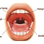 Viêm họng hạt là bệnh gì? Những triệu chứng nhận biết bệnh