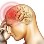 Viêm màng não - Tìm hiểu cách phát hiện bệnh