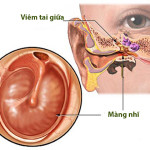 Viêm tai giữa là gì? Đây là những triệu chứng nhận biết bệnh?