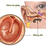 Viêm tai giữa là gì? Đây là những triệu chứng nhận biết bệnh?