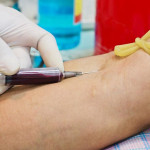 Albumin máu - Ý nghĩa của việc xét nghiệm Albumin trong máu