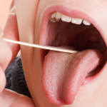 Bật mí các cách trị viêm amidan tại nhà hiệu quả