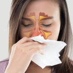 Cách trị viêm xoang mũi tại nhà hiệu quả không dùng thuốc