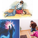 Hướng dẫn cách xử lý khi gặp đột quỵ