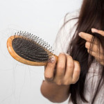 Mách bạn cách trị rụng tóc nhanh chóng tại nhà